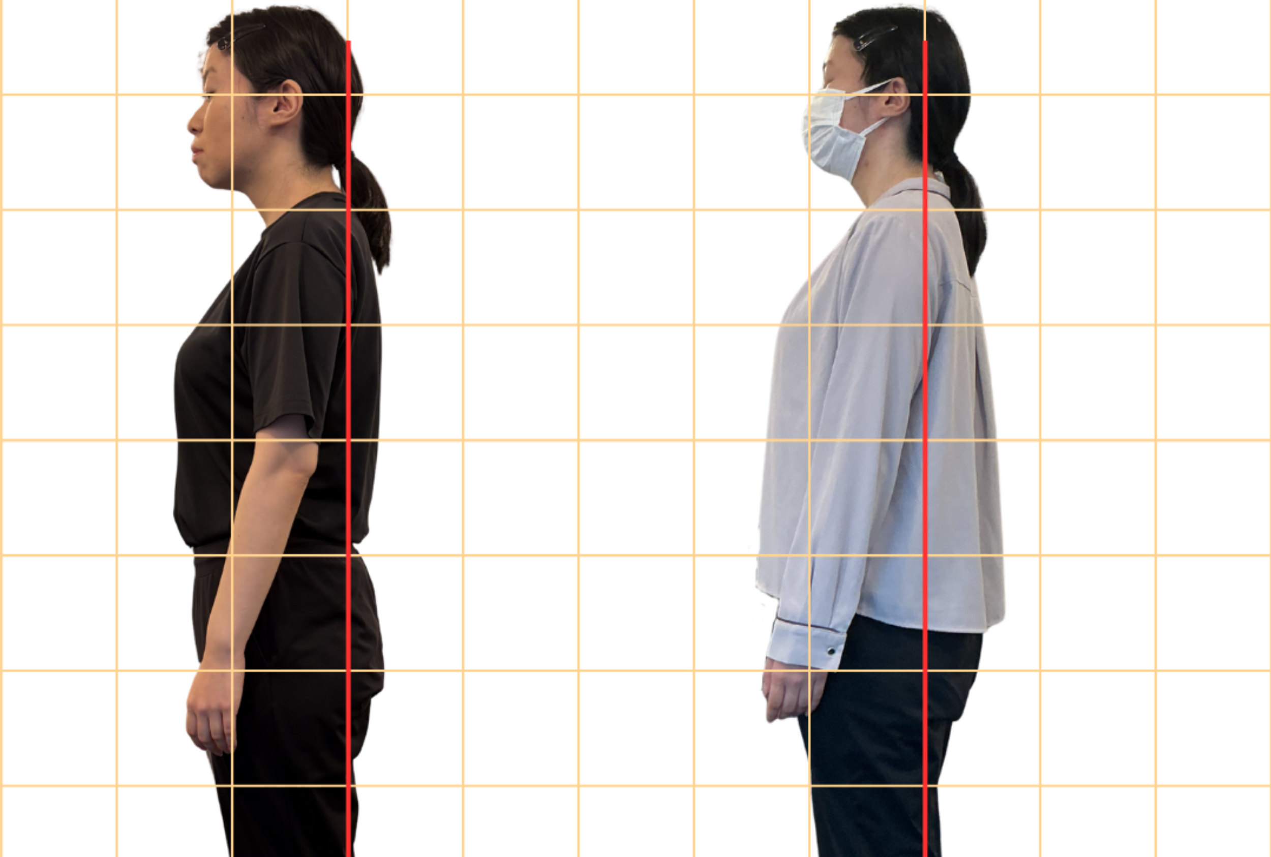 20代女性 ストレートネック姿勢の変化